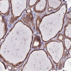 Invitrogen OR52I2 Polyclonal Antibody 100 &mu;L; Unconjugated:Antibodies,
