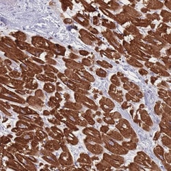 Invitrogen RNF4 Polyclonal Antibody 100 &mu;L; Unconjugated:Antibodies,