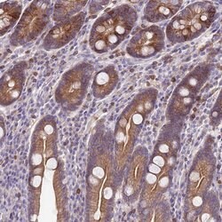Invitrogen WDR90 Polyclonal Antibody 100 &mu;L; Unconjugated:Antibodies,