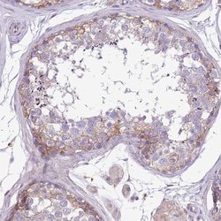 Invitrogen WDR90 Polyclonal Antibody 100 &mu;L; Unconjugated:Antibodies,