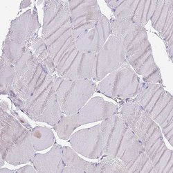 Invitrogen WDR90 Polyclonal Antibody 100 &mu;L; Unconjugated:Antibodies,