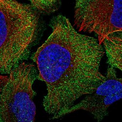 Invitrogen C16orf74 Polyclonal Antibody 100 &mu;L | Buy Online | Invitrogen&trade; | Fisher Scientific