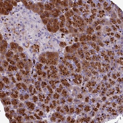 Invitrogen C16orf74 Polyclonal Antibody 100 &mu;L | Buy Online | Invitrogen&trade; | Fisher Scientific