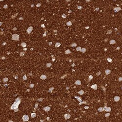 Invitrogen TIFAB Polyclonal Antibody 100 &mu;L; Unconjugated:Antibodies,