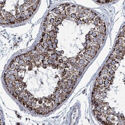Invitrogen IDH3B Polyclonal Antibody 100 &mu;L; Unconjugated:Antibodies,