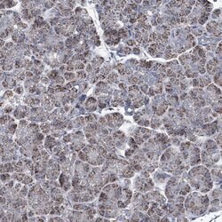 Invitrogen IDH3B Polyclonal Antibody 100 &mu;L; Unconjugated:Antibodies,