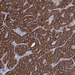 Invitrogen IDH3B Polyclonal Antibody 100 &mu;L; Unconjugated:Antibodies,