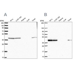 Invitrogen IDH3B Polyclonal Antibody 100 &mu;L; Unconjugated:Antibodies,