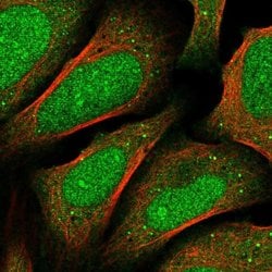 Invitrogen FBXO46 Polyclonal Antibody 100 &mu;L; Unconjugated:Antibodies,