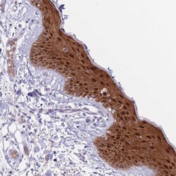 Invitrogen FBXO46 Polyclonal Antibody 100 &mu;L; Unconjugated:Antibodies,