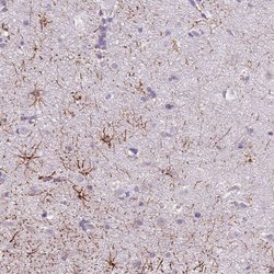 Invitrogen SLC35E3 Polyclonal Antibody 100 &mu;L | Buy Online | Invitrogen&trade; | Fisher Scientific