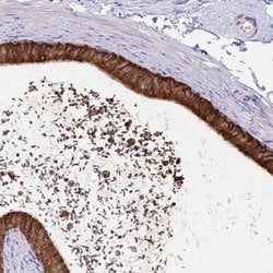 Invitrogen FKBP2 Polyclonal Antibody 100 &mu;L; Unconjugated:Antibodies,