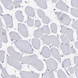 Invitrogen FKBP2 Polyclonal Antibody 100 &mu;L; Unconjugated:Antibodies,