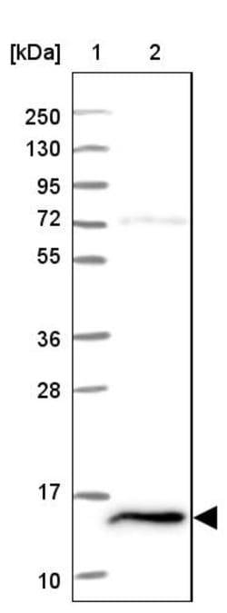 Invitrogen FKBP2 Polyclonal Antibody 100 &mu;L; Unconjugated:Antibodies,