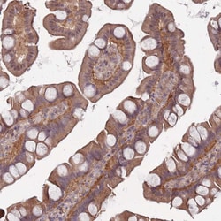 Invitrogen Naked1 Polyclonal Antibody 100 &mu;L | Buy Online | Invitrogen&trade; | Fisher Scientific