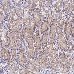 Invitrogen SPIRE2 Polyclonal Antibody 100 &mu;L; Unconjugated:Antibodies,