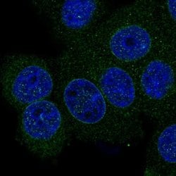 Invitrogen SMPD4 Polyclonal Antibody 100 &mu;L; Unconjugated:Antibodies,