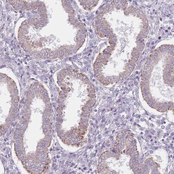 Invitrogen SMPD4 Polyclonal Antibody 100 &mu;L; Unconjugated:Antibodies,