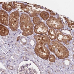 Invitrogen SMPD4 Polyclonal Antibody 100 &mu;L; Unconjugated:Antibodies,