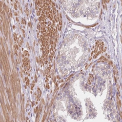 Invitrogen SMPD4 Polyclonal Antibody 100 &mu;L; Unconjugated:Antibodies,