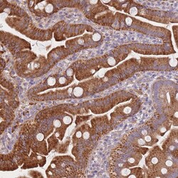 Invitrogen SMPD4 Polyclonal Antibody 100 &mu;L; Unconjugated:Antibodies,