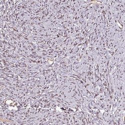 Invitrogen NOB1 Polyclonal Antibody 100 &mu;L; Unconjugated:Antibodies,