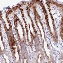 Invitrogen MIDN Polyclonal Antibody 100 &mu;L; Unconjugated:Antibodies,