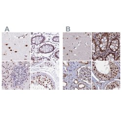 Invitrogen SF3A2 Polyclonal Antibody 100 &mu;L; Unconjugated:Antibodies,