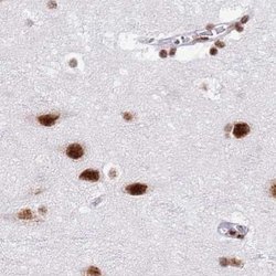 Invitrogen SF3A2 Polyclonal Antibody 100 &mu;L; Unconjugated:Antibodies,