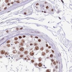 Invitrogen SF3A2 Polyclonal Antibody 100 &mu;L; Unconjugated:Antibodies,