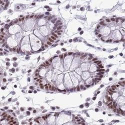 Invitrogen SF3A2 Polyclonal Antibody 100 &mu;L; Unconjugated:Antibodies,