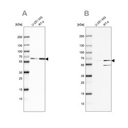Invitrogen SF3A2 Polyclonal Antibody 100 &mu;L; Unconjugated:Antibodies,