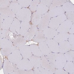 Invitrogen RAVER1 Polyclonal Antibody 100 &mu;L; Unconjugated:Antibodies,