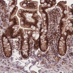 Invitrogen RAVER1 Polyclonal Antibody 100 &mu;L; Unconjugated:Antibodies,