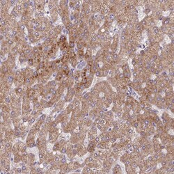 Invitrogen Adenylate Kinase 4 Polyclonal Antibody 100 &mu;L; Unconjugated:Antibodies,