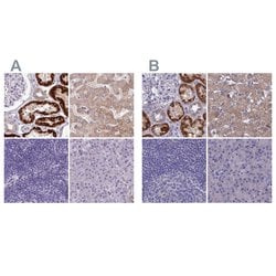 Invitrogen Adenylate Kinase 4 Polyclonal Antibody 100 &mu;L; Unconjugated:Antibodies,