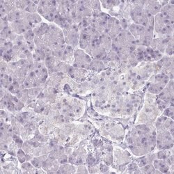 Invitrogen Adenylate Kinase 4 Polyclonal Antibody 100 &mu;L; Unconjugated:Antibodies,
