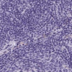 Invitrogen Adenylate Kinase 4 Polyclonal Antibody 100 &mu;L; Unconjugated:Antibodies,