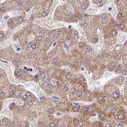 Invitrogen Adenylate Kinase 4 Polyclonal Antibody 100 &mu;L; Unconjugated:Antibodies,