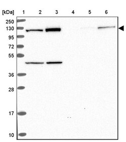 Invitrogen eIF3c Polyclonal Antibody 100 &mu;L | Buy Online | Invitrogen&trade; | Fisher Scientific