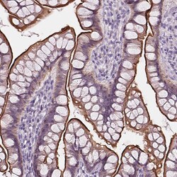 Invitrogen C19orf21 Polyclonal Antibody 100 &mu;L; Unconjugated:Antibodies,