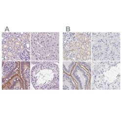 Invitrogen C19orf21 Polyclonal Antibody 100 &mu;L; Unconjugated:Antibodies,