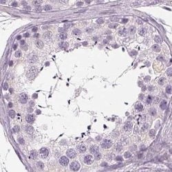 Invitrogen C19orf21 Polyclonal Antibody 100 &mu;L; Unconjugated:Antibodies,