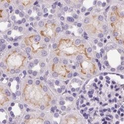 Invitrogen C19orf21 Polyclonal Antibody 100 &mu;L; Unconjugated:Antibodies,