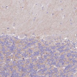 Invitrogen C2orf88 Polyclonal Antibody 100 &mu;L; Unconjugated:Antibodies,