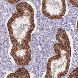 Invitrogen C2orf88 Polyclonal Antibody 100 &mu;L; Unconjugated:Antibodies,