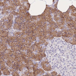 Invitrogen C2orf88 Polyclonal Antibody 100 &mu;L; Unconjugated:Antibodies,
