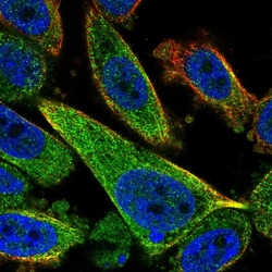 Invitrogen TCTEX1D2 Polyclonal Antibody 100 &mu;L; Unconjugated:Antibodies,