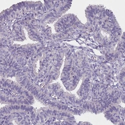 Invitrogen SLC35E4 Polyclonal Antibody 100 &mu;L; Unconjugated:Antibodies,