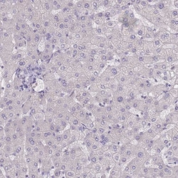 Invitrogen SLC35E4 Polyclonal Antibody 100 &mu;L; Unconjugated:Antibodies,